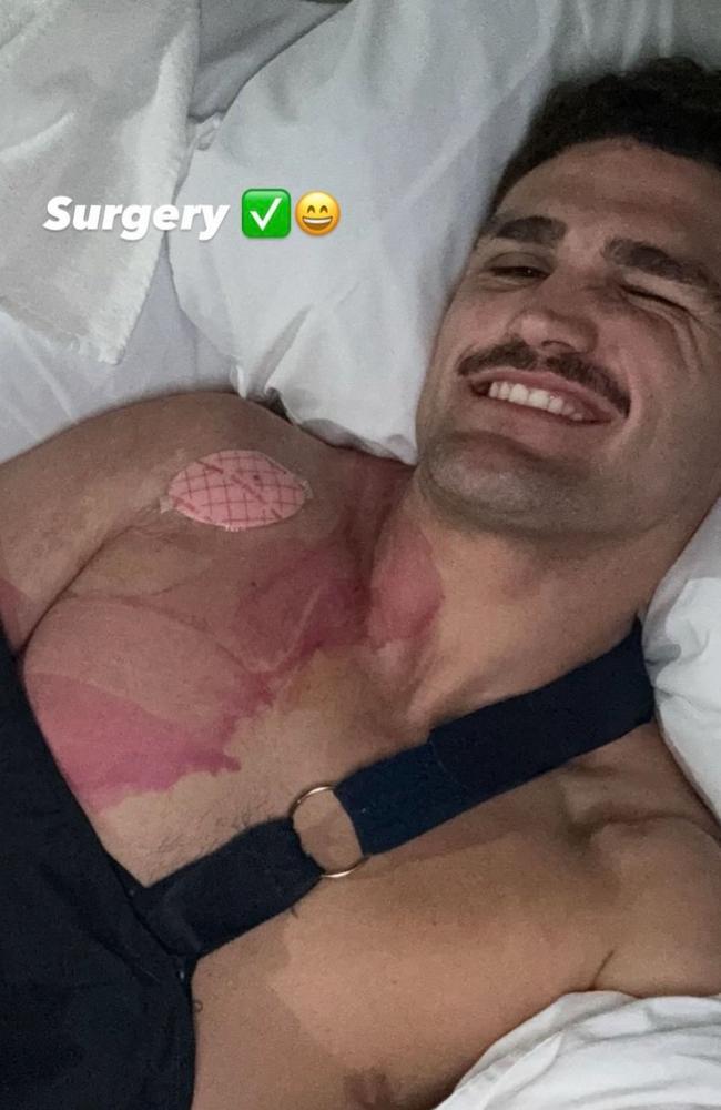 Penrith halfback Nathan Cleary after shoulder surgery. Picture: Instagram