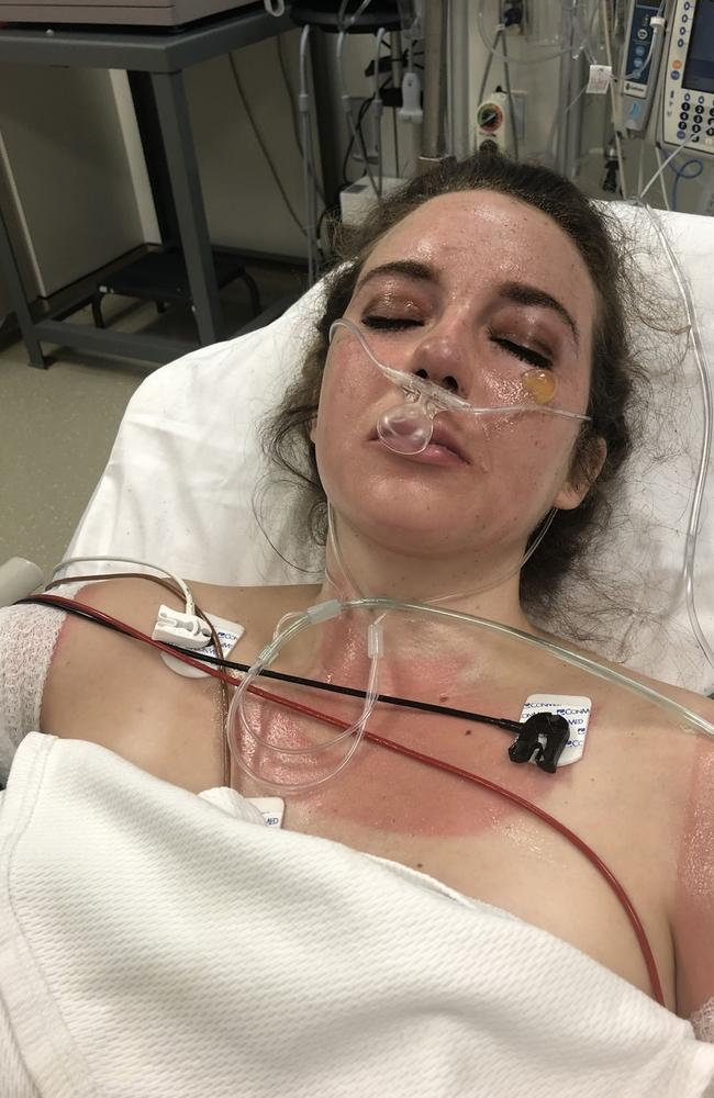 She was severely burned by what happened in the kitchen. Picture: Kennedy News and Media