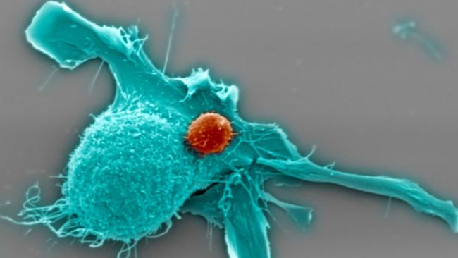 CAR T cells (the small one, red or pink) sitting on a breast cancer cells (the big cell, cyan or yellow/green). These are electron microscopy pictures.