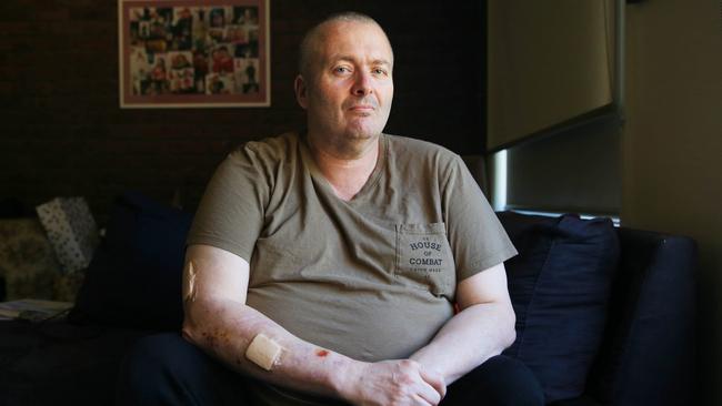 The CFA rejected Rob Gibbs’ cancer compensation claim after he was diagnosed with chronic myeloid leukaemia in May 2015. Picture: Aaron Francis