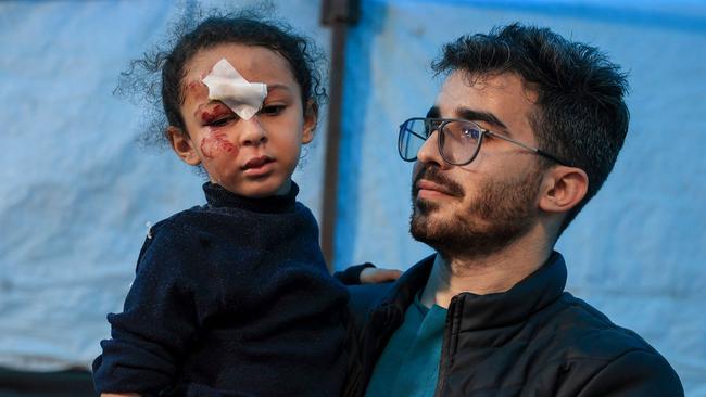 EDITORS NOTE: Graphic content / A child injured during Israeli bombardment receives treatment at the Kuwait Hospital in Rafah in the southern Gaza Strip on December 20, 2023, amid ongoing battles between Israel and the Palestinian militant group Hamas. (Photo by SAID KHATIB / AFP)