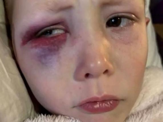 The parents of a five-year-old boy in NSW have called for action after their son was allegedly brutally attacked with a golf club by another kid. Picture: 7NEWS