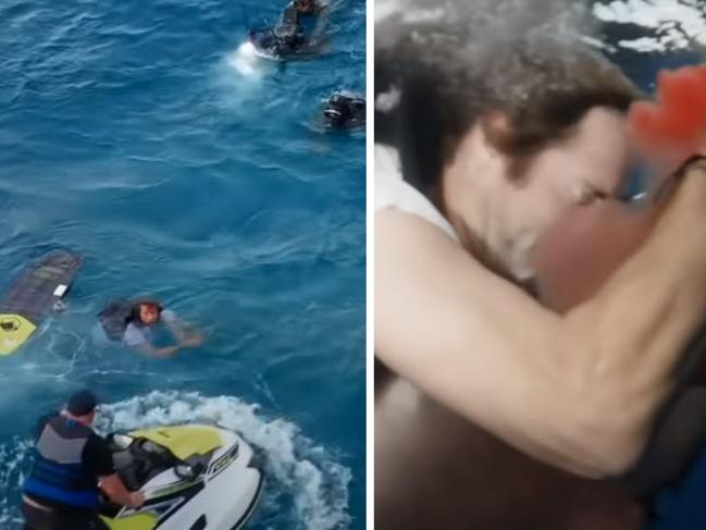 Jackass stuntman 'Poopies' as his arm was left "dangling my the tendons" after a shark attack. Photo: supplied.