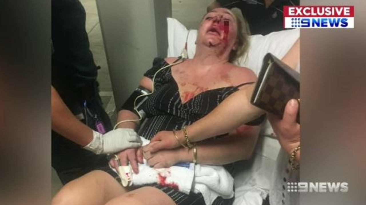 Ms Martin spent several days in hospital following the alleged attack. Picture: Nine News