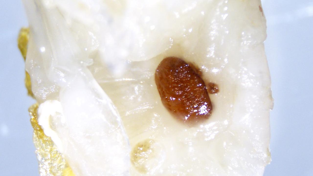 A varroa mite attached to an Asian honey bee pupae.