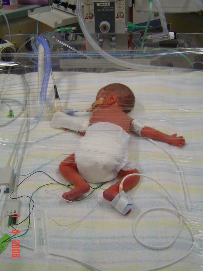 A fragile baby Carlos was born at Mater Mothers' Hospital 13 weeks early, weighing 743 grams. Photo: Supplied.