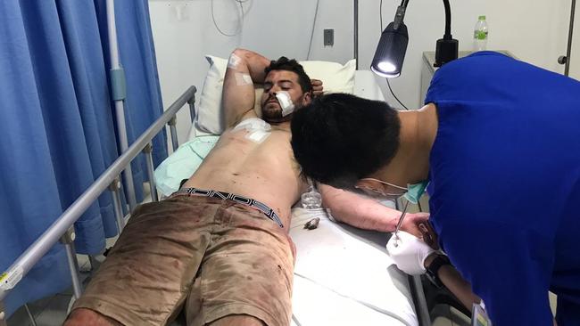 South Australian Nicholas Carr in hospital recovering from injuries sustained after a bizarre rampage on a busy street in Bali. Picture: Lukman S. Bintoro