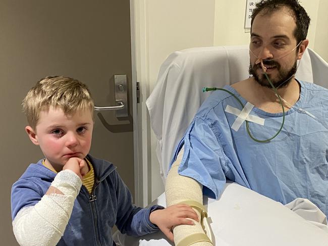 Ben Hyde recovering in the Royal Adelaide Hospital after he was seriously injured in a crash on West Tce, Adelaide, on October 4, 2021. Pictures: Tania Hyde