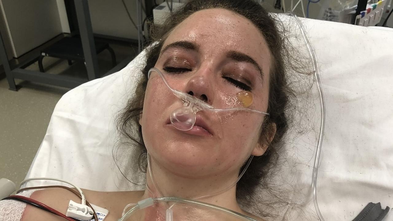 Bride-to-be’s face ‘melted’ off in disaster. Picture: Kennedy News