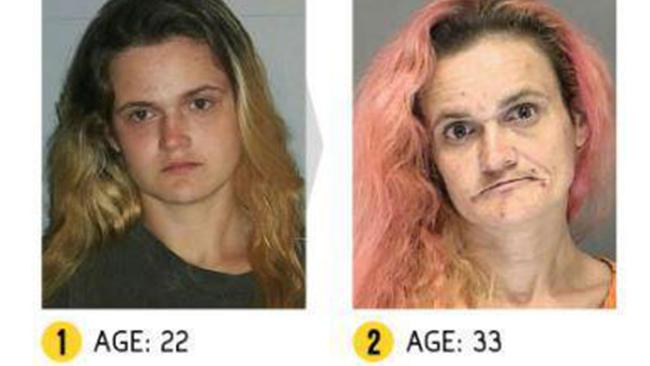 Drug Addiction Before And After Photos Show Shocking Reality Of Addicts Daily Telegraph