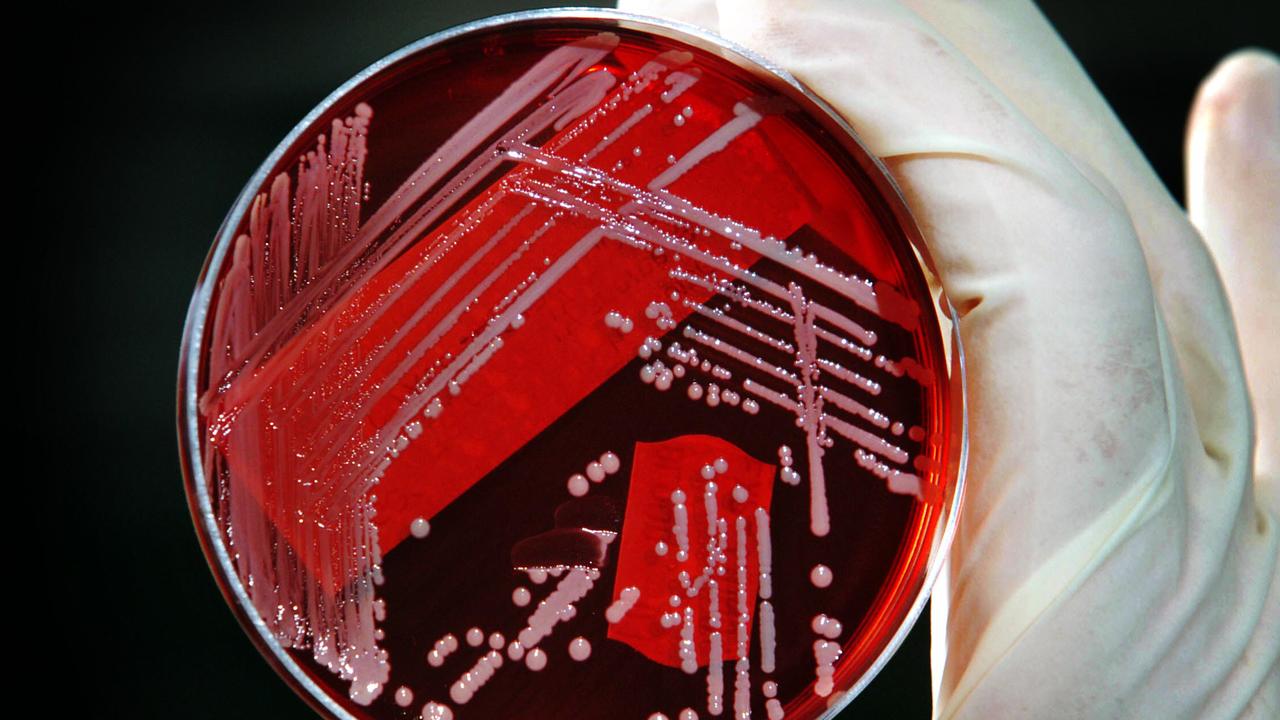 Worrying sign superbugs are on track to kill 39 million people