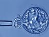 Monash IVF settle ‘faulty genetic test’ lawsuit for $54m