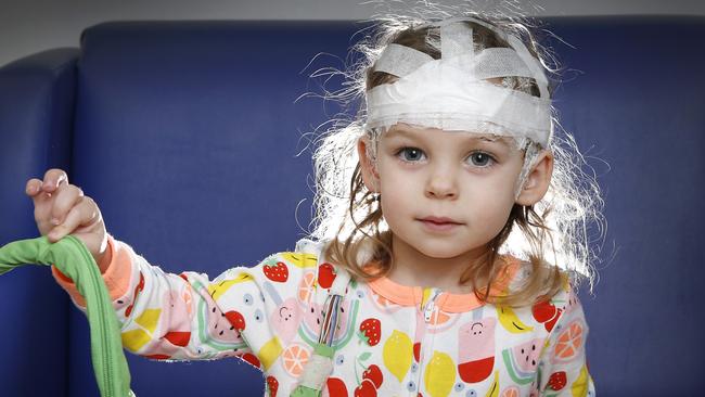 Piper Crawford when she was 2 having her epilepsy mapping test. Picture: David Caird