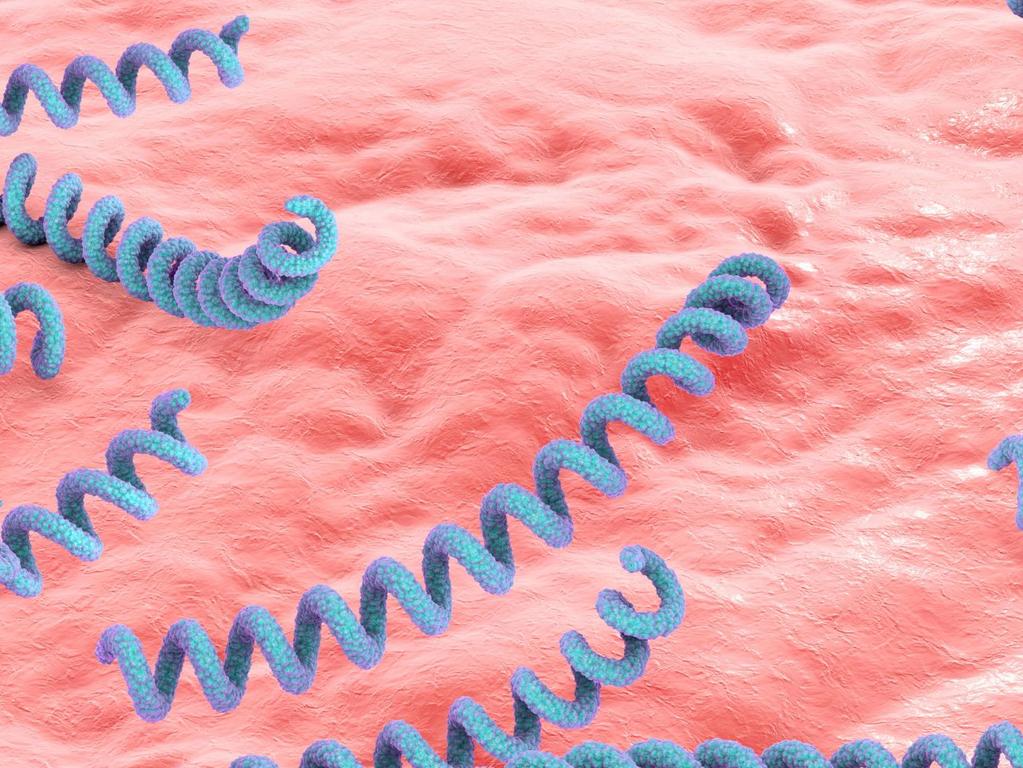 Syphilis cases are rising in Australia.