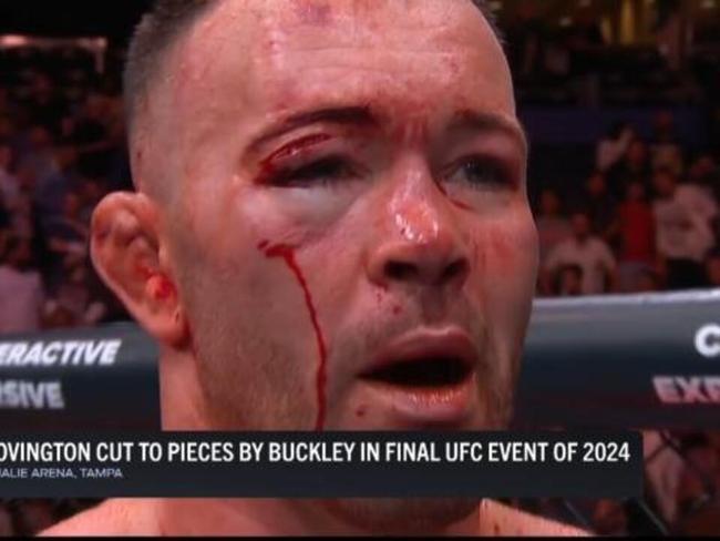 Covington cut up by Buckley in TKO loss