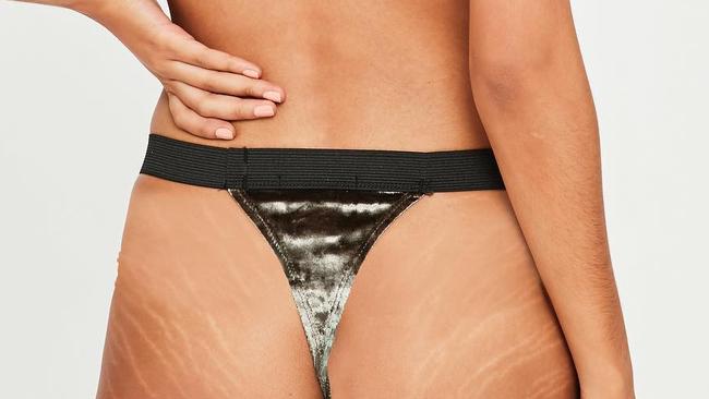 Real or not? Online fashion chain Missguided has denied re-touching a lingerie models’s stretch marks in its latest campaign. Picture: @missguided/Instagram