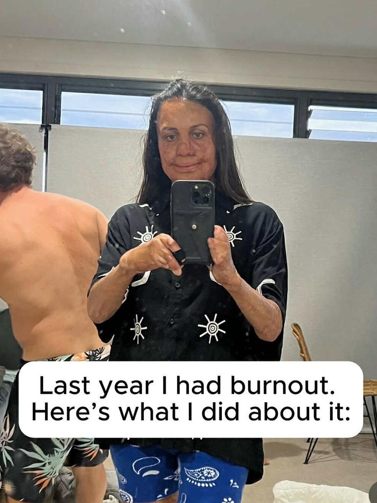 Turia Pitt opened up about her struggle with burnout. Picture: Instagram
