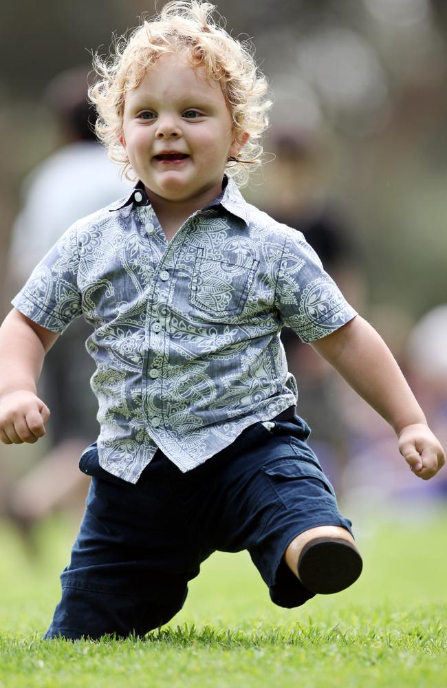 Ted was born with a rare congenital condition, arriving into the world with no shinbones, knees and ankles.