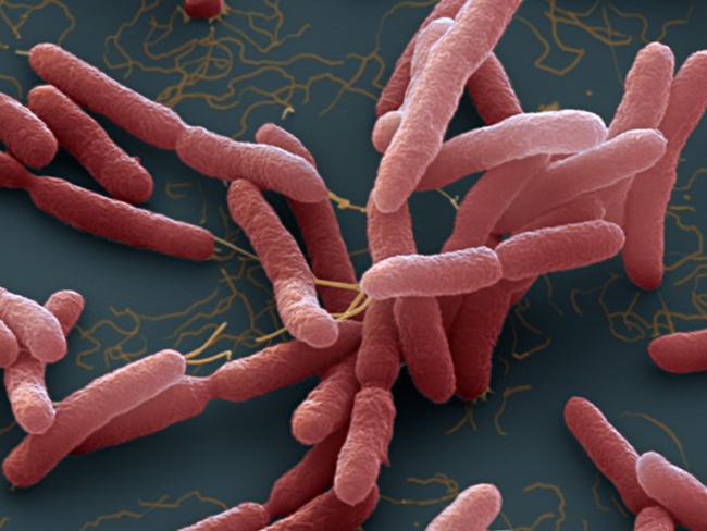 Burkholderia pseudomallei. A bacteria which cause melioidosis, a  disease spread through contaminated water and soil.