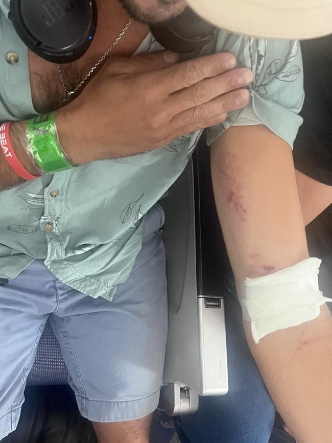 A passeneger injured on the Latam flight from Sydney to Auckland. Picture: Brian Jokat