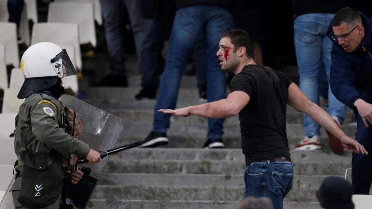 An Ajax fan reacts after being left bloodied following the chaos