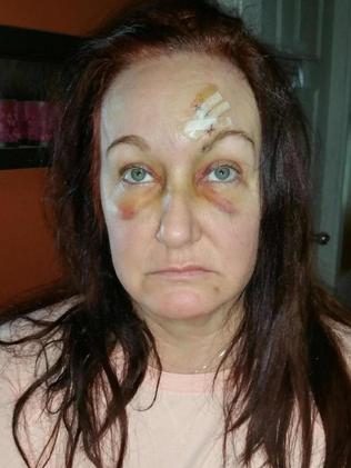 Woman bashed with hammer at KFC carpark says domestic violence victims ...