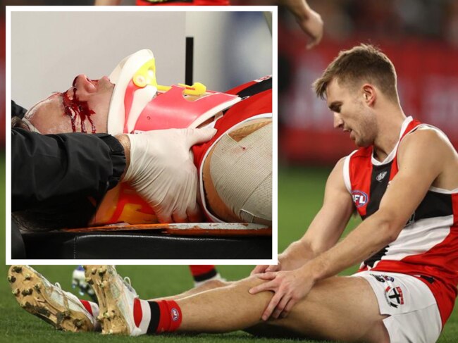 Facial surgery for Saint after sickening friendly-fire clash