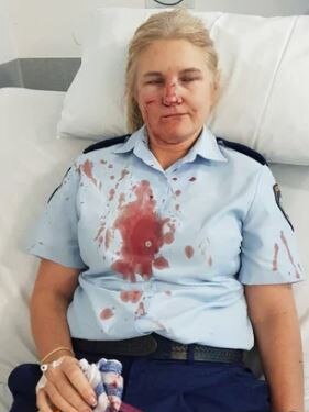 Sergeant Rachael Robins after she was assaulted by Aaron Heather. Picture: supplied