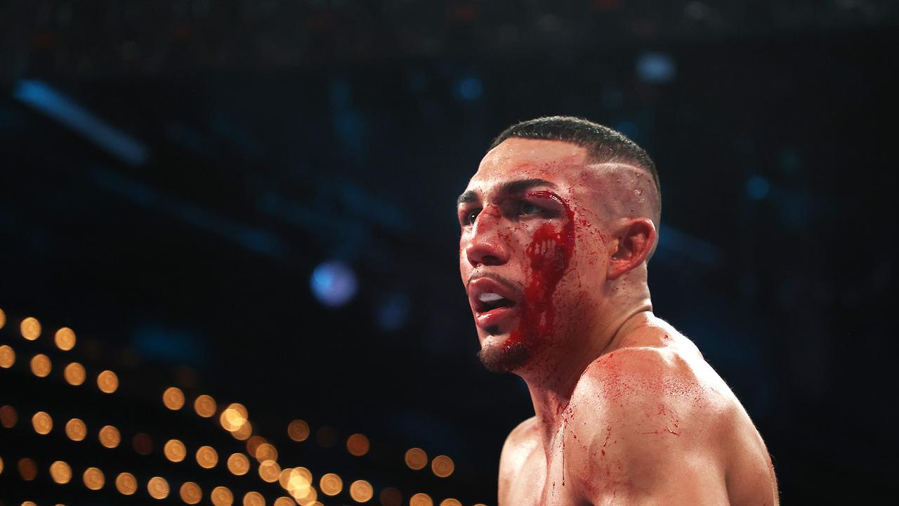 NEW YORK, NEW YORK - NOVEMBER 27: Teofimo Lopez stands bloodied during his bout against George Kambosos for Lopezâ&#128;&#153;s Undisputed Lightweight title at The Hulu Theater at Madison Square Garden on November 27, 2021 in New York, New York. (Photo by Al Bello/Getty Images)