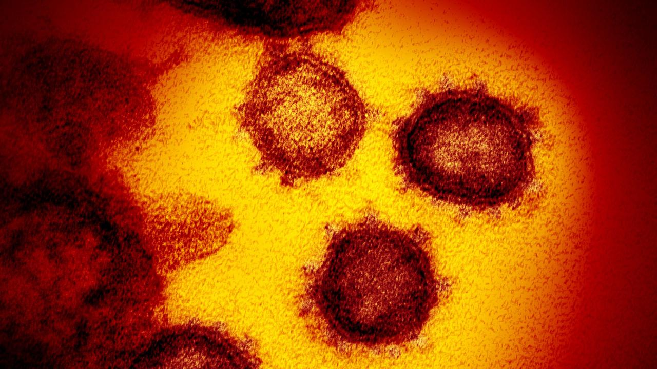 A microscopic image of the Covid-19 virus. Picture: National Institutes of Health/AFP