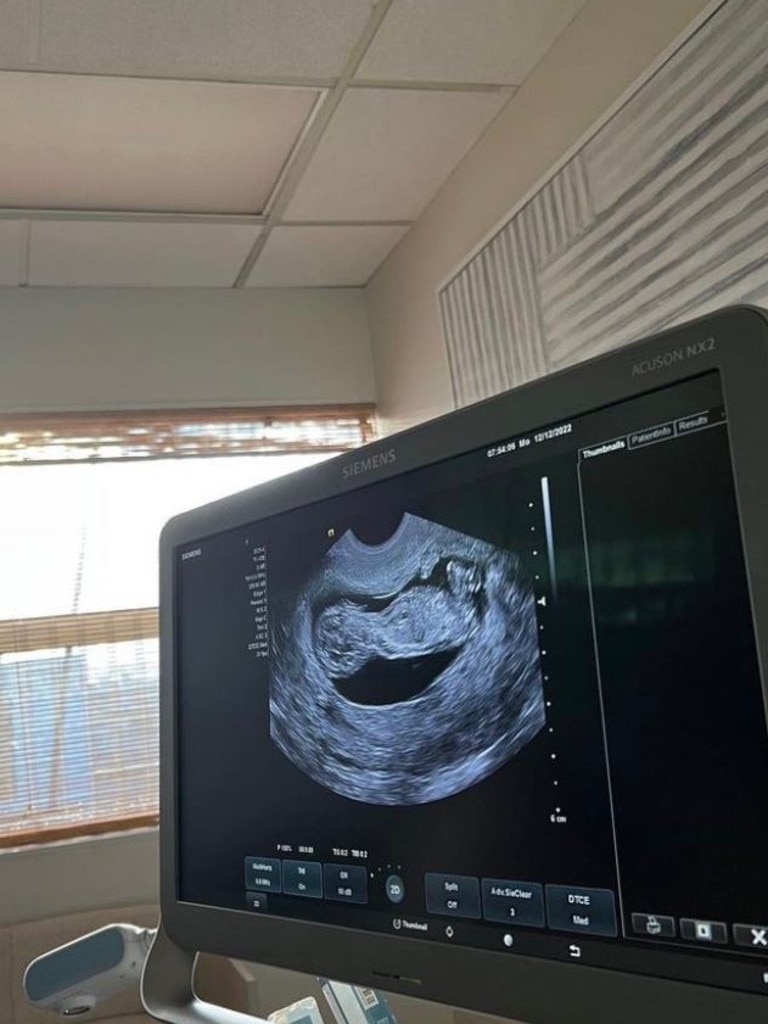 She posted a photo of her baby. Picture: Instagram