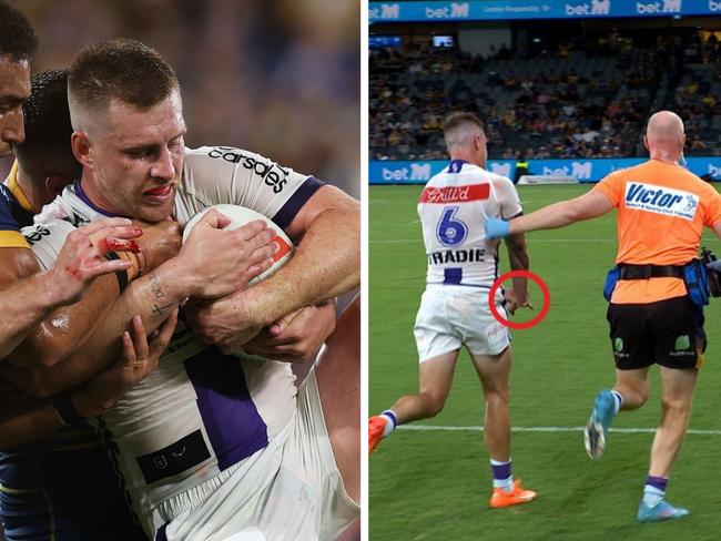 Cameron Munster played through the pain. Photo: Getty Images and Fox League