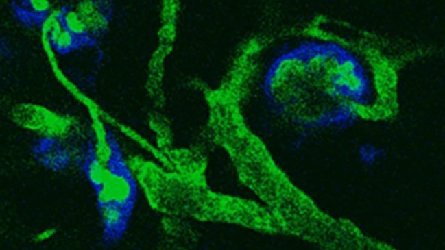 Mini-kidneys transplanted into mice glow different colours to show blood running through the filters. Picture: Murdoch Children's Research Institute.