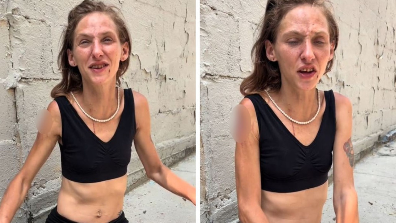 Disturbing video of an emaciated young woman covered in sores has been described as a heartbreaking view of the “American tragedy”.