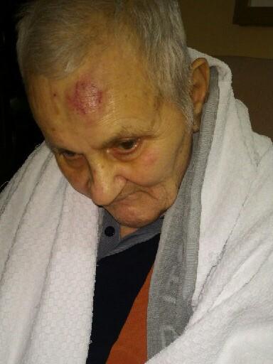 Ermanno Serpo with injuries while he was a resident at Oakden Mental Health Centre. Picture: Supplied