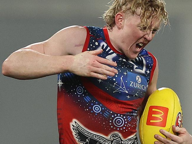 GEELONG, AUSTRALIA - JULY 07: Clayton Oliver of the Demons reacts after he was kicked in the hand during the round 17 AFL match between the Geelong Cats and the Melbourne Demons at GMHBA Stadium on July 07, 2022 in Geelong, Australia. (Photo by Robert Cianflone/Getty Images)