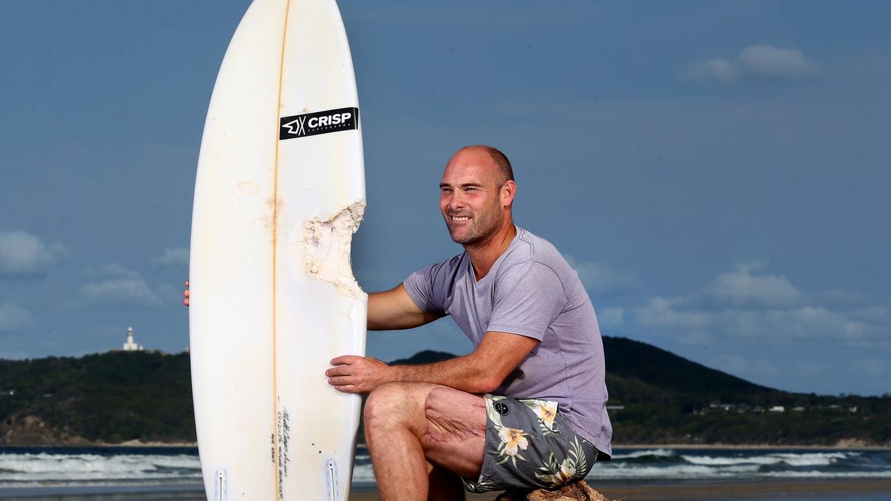 Sam Edwardes with the scars on his legs and the chunk out of the board PICTURE: Adam Head