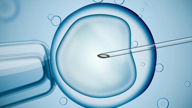 Laboratory microscopic research of IVF (in vitro fertilization). Digital illustration. For Leader group read on IVF. Picture: iSTOCK