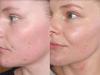 ‘Holy grail’ skin buy 30k are ‘hooked’ on