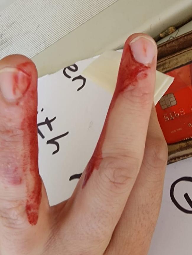 Deakin employee Yotam Barazani was left with bloody cuts after he was set upon.