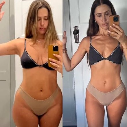 Influencer Ruby Tuesday Matthews has been accused of photoshopping the ‘before’ image. Picture: Instagram/Ruby Tuesday Matthews