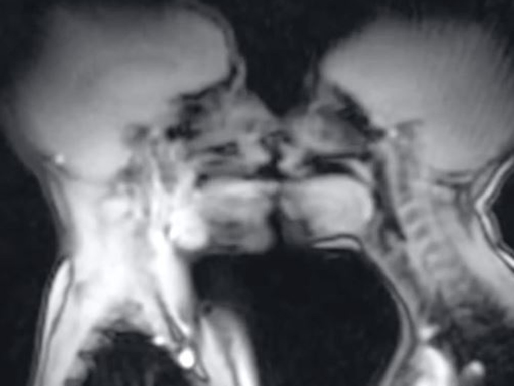 In 1991, a couple had sex in an MRI machine, and the story is going viral on TikTok. Picture: BMJ