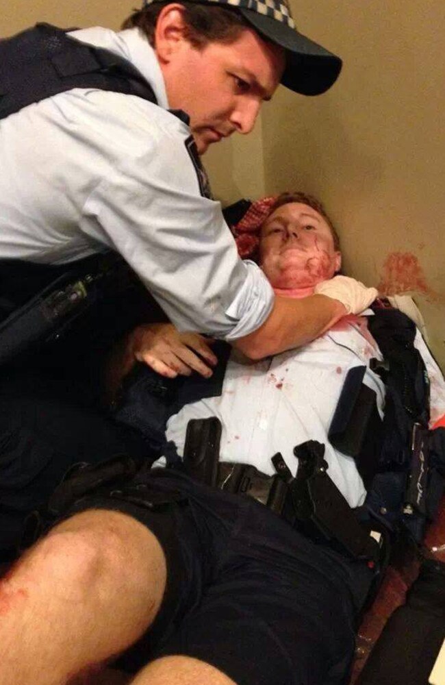 Sen-Constable Weiks after the attack in a Townsville nightclub in December 2013.