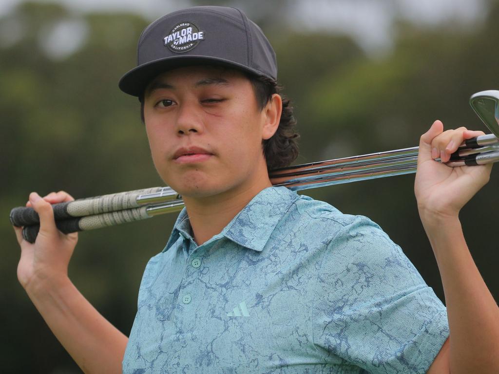 Young Australian golfer Jeff Guan has spoken openly about the horrific incident which has derailed his career. Photo: David Tease/Golf NSW.