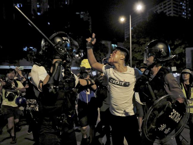 A bleeding man reacts as he is taken away by policemen after attacked by protesters outside Kwai Chung police station in Hong Kong, Wednesday, July 31, 2019. Protesters clashed with police again in Hong Kong on Tuesday night after reports that some of their detained colleagues would be charged with the relatively serious charge of rioting. (AP Photo/Vincent Yu)