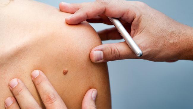 The new Oasis Medical Centre Gold Coast centre has a range of services, including the Molemax machine, called the “best equipment to diagnose skin cancer”.