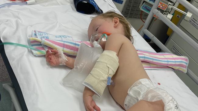 Nola Rose is one of thousands of children hospitalised every year with RSV. Picture: Supplied