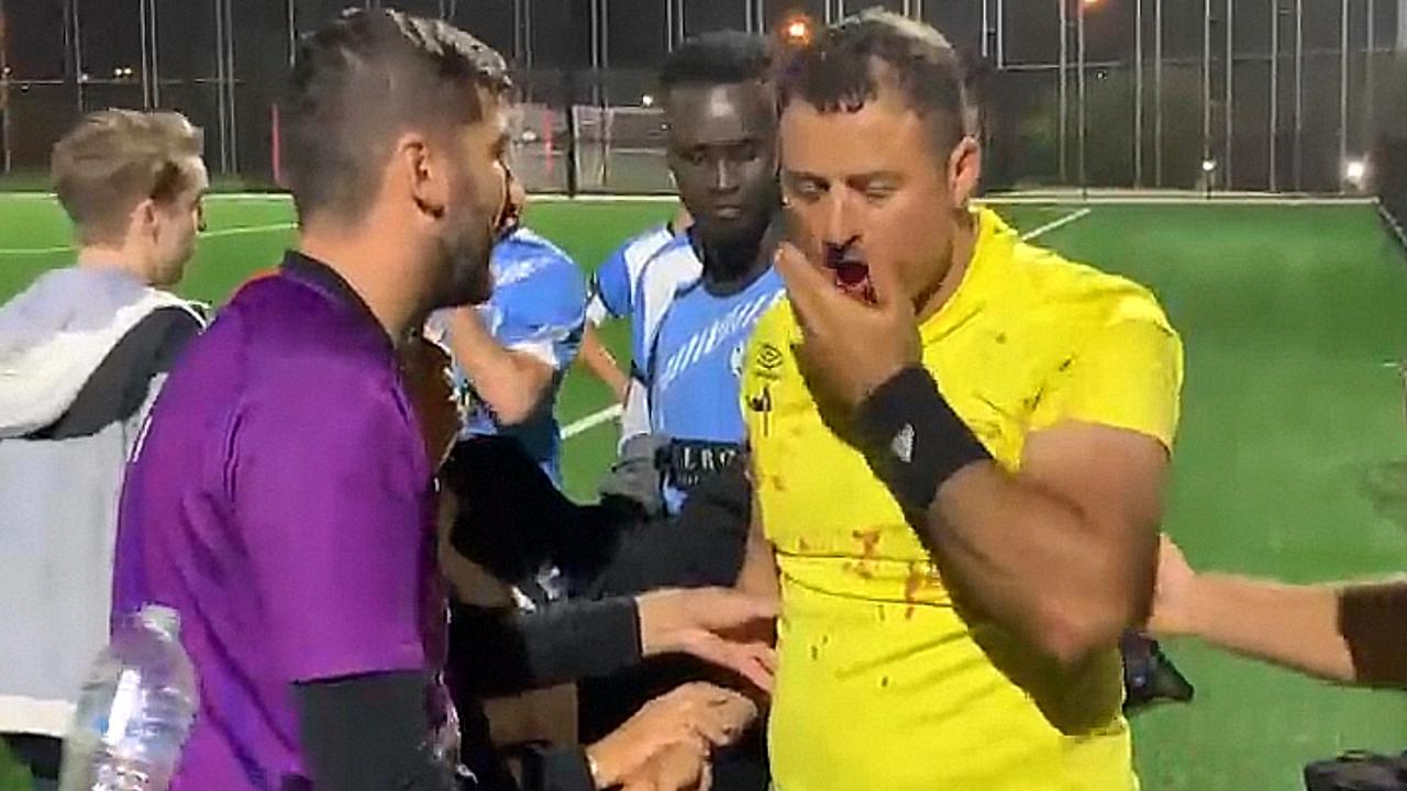 Man arrested after soccer referee attack