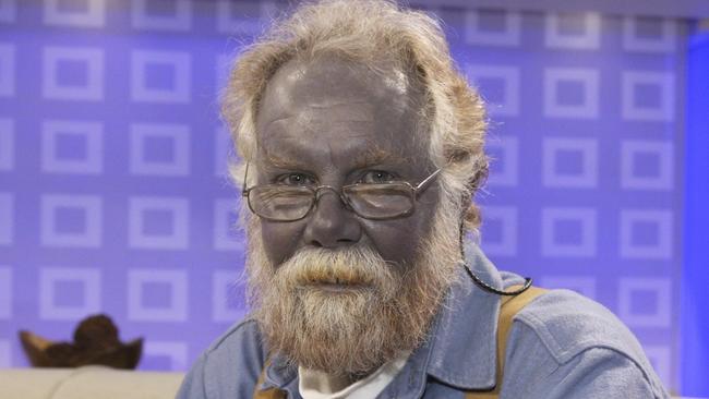 Before he died from poisoning himself with colloidal silver, Paul Karason’s skin turned blue. “Kelly’s” mother-in-law was feeding it to Kelly’s children.