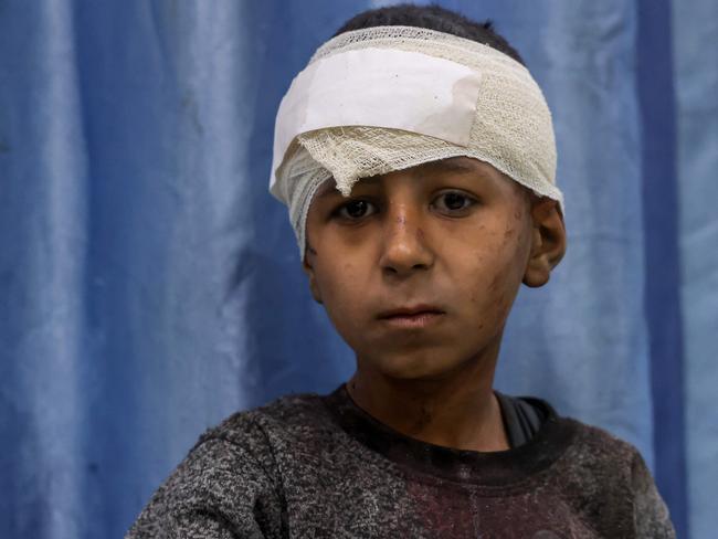 An injured Palestinian boy stands at the Indonesian Hospital in Beit Lahia following Israeli air strikes in the northern Gaza Strip. Picture: AFP